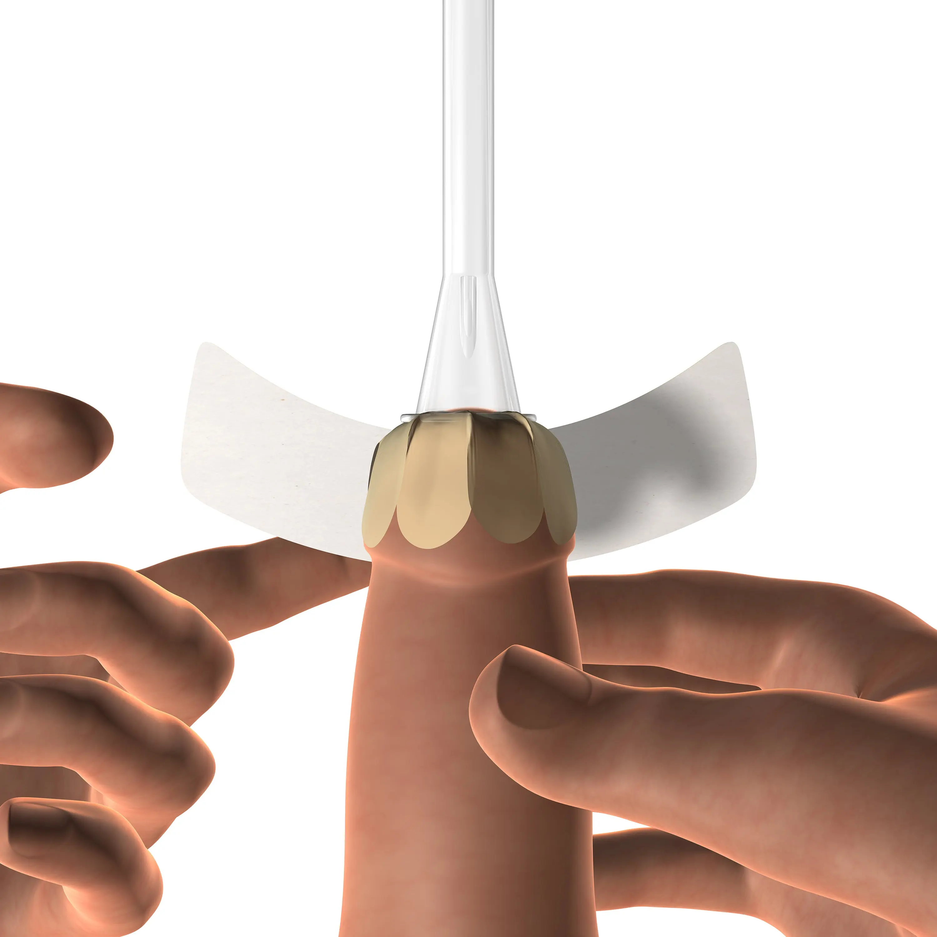 Afex Bioderm XLS - Male Urinary Incontinence Management (Oval) (x10) - Image 4